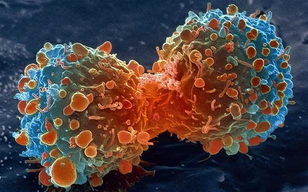 cancer-lambert_2469736b